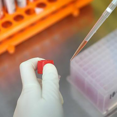 Bệnh truyền nhiễm Real Time PCR Monkeypox Test Kit MPXV CE Đã đăng ký 1 Test/Hộp